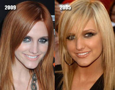 미국에서 많이하는 성형수술 세가지 | 인스티즈