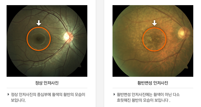 광주안과의원 이미지