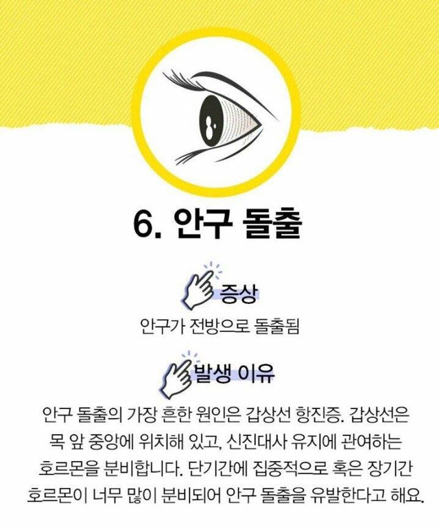눈으로 알 수 있는 질병 | 인스티즈