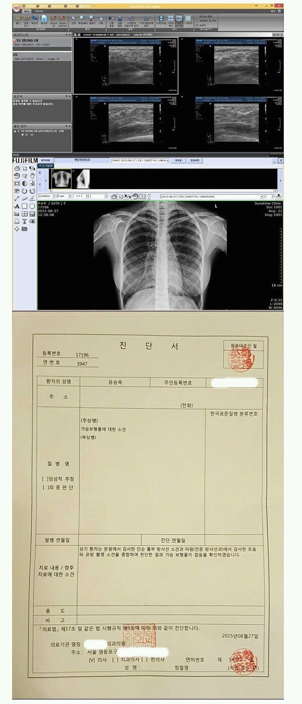 본인의 원래 가슴임을 인증한 유승옥 | 인스티즈