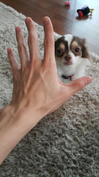 힘줄 이미지