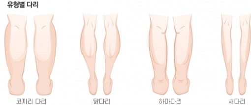 퉁퉁부은 무다리 탈출법 꿀팁 | 인스티즈