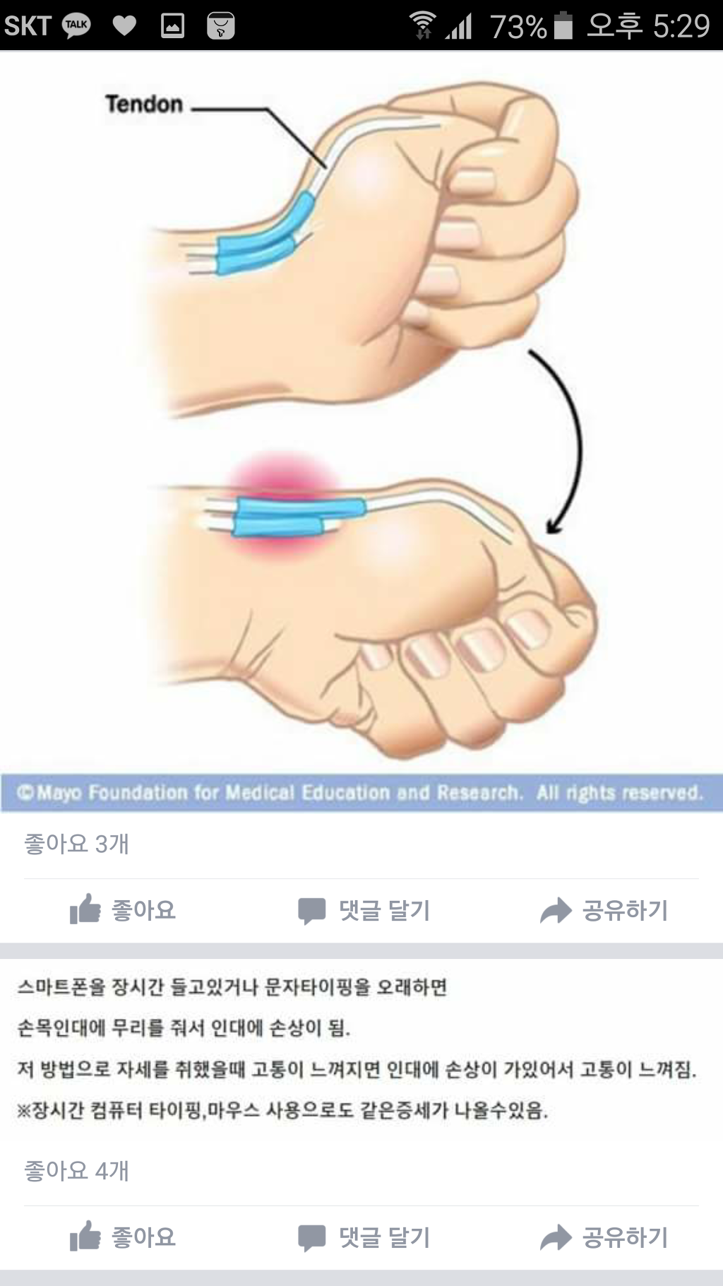 스마트폰으로 인한 인대손상테스트(진짜인지아닌지모름 따라하면 아플수도) | 인스티즈
