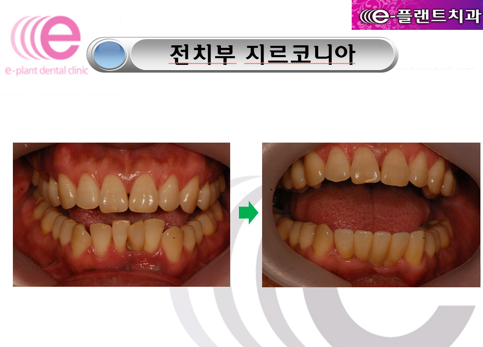 e-플랜트치과 이미지