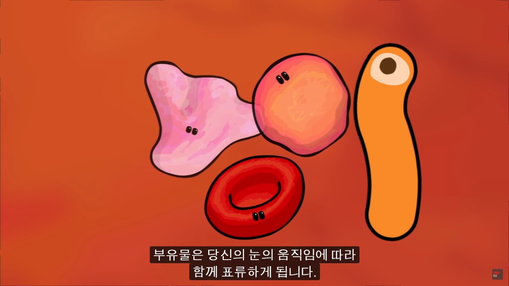 여러분의 눈에 둥둥 떠다니는 그것들은 무엇일까요? | 인스티즈